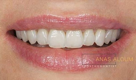 What Makes a Good Dentist? Qualities to Look for in Your Dental Care Provider